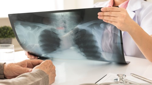X-ray