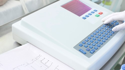 Electrocardiogram (ECG)